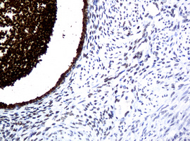 WFDC2 / HE4 Antibody - IHC of paraffin-embedded Human endometrium tissue using anti-WFDC2 mouse monoclonal antibody.