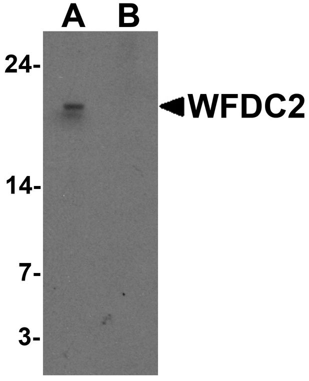 WFDC2 / HE4 Antibody - Western blot analysis of WFDC2 in A549 cell lysate with WFDC2 antibody at 1 ug/ml in (A) the absence and (B) the presence of blocking peptide.