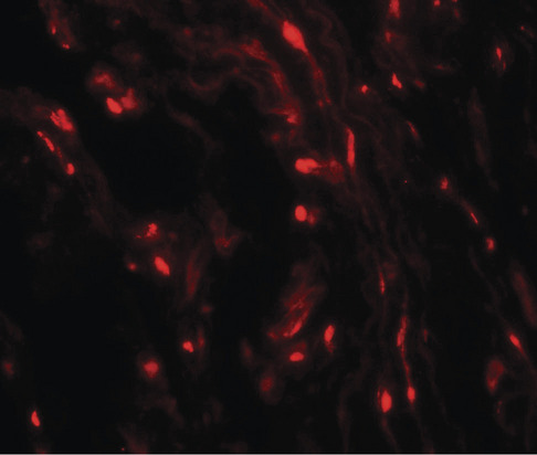 WFDC2 / HE4 Antibody - Immunofluorescence of WFDC2 in human lung tissue with WFDC2 antibody at 20 ug/ml.