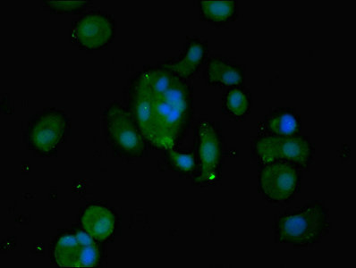 WFDC2 / HE4 Antibody - Immunofluorescent analysis of MCF-7 cells using WFDC2 Antibody at dilution of 1:100 and Alexa Fluor 488-congugated AffiniPure Goat Anti-Rabbit IgG(H+L)