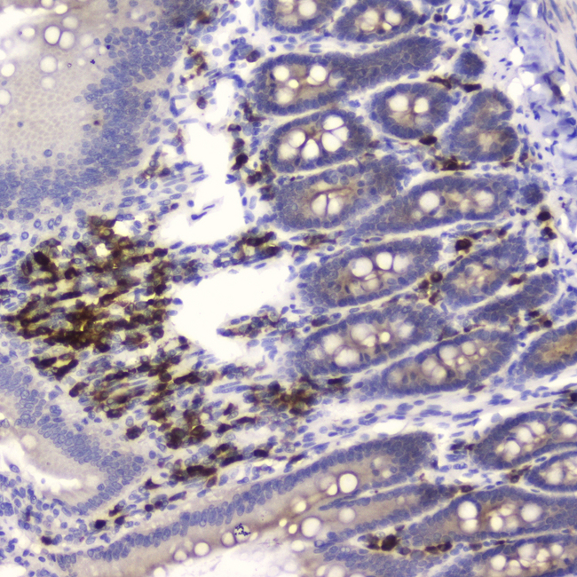 WFDC2 / HE4 Antibody - IHC analysis of HE4 using anti-HE4 antibody. HE4 was detected in paraffin-embedded section of rat small intestine tissue. Heat mediated antigen retrieval was performed in citrate buffer (pH6, epitope retrieval solution) for 20 mins. The tissue section was blocked with 10% goat serum. The tissue section was then incubated with 2?g/ml rabbit anti-HE4 Antibody overnight at 4?C. Biotinylated goat anti-rabbit IgG was used as secondary antibody and incubated for 30 minutes at 37?C. The tissue section was developed using Strepavidin-Biotin-Complex (SABC) with DAB as the chromogen.