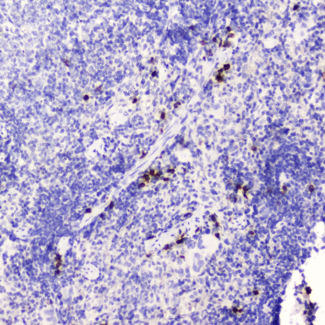 WFDC2 / HE4 Antibody - IHC analysis of HE4 using anti-HE4 antibody. HE4 was detected in paraffin-embedded section of mouse spleen tissue . Heat mediated antigen retrieval was performed in citrate buffer (pH6, epitope retrieval solution) for 20 mins. The tissue section was blocked with 10% goat serum. The tissue section was then incubated with 2?g/ml rabbit anti-HE4 Antibody overnight at 4?C. Biotinylated goat anti-rabbit IgG was used as secondary antibody and incubated for 30 minutes at 37?C. The tissue section was developed using Strepavidin-Biotin-Complex (SABC) with DAB as the chromogen.