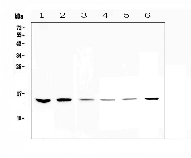 WFDC2 / HE4 Antibody - Western blot analysis of HE4 using anti-HE4 antibody. Electrophoresis was performed on a 5-20% SDS-PAGE gel at 70V (Stacking gel) / 90V (Resolving gel) for 2-3 hours. The sample well of each lane was loaded with 50ug of sample under reducing conditions. Lane 1: human Hela whole cell lysates,Lane 2: human MDA-MB-231 whole cell lysates,Lane 3: human MDA-MB-453 whole cell lysates,Lane 4: rat thymus tissue lysates, Lane 5: mouse testis tissue lysates, Lane 6: mouse thymus tissue lysates. After Electrophoresis, proteins were transferred to a Nitrocellulose membrane at 150mA for 50-90 minutes. Blocked the membrane with 5% Non-fat Milk/ TBS for 1.5 hour at RT. The membrane was incubated with rabbit anti-HE4 antigen affinity purified polyclonal antibody at 0.5 ?g/mL overnight at 4?C, then washed with TBS-0.1% Tween 3 times with 5 minutes each and probed with a goat anti-rabbit IgG-HRP secondary antibody at a dilution of 1:10000 for 1.5 hour at RT. The signal is developed using an Enhanced Chemiluminescent detection (ECL) kit with Tanon 5200 system. A specific band was detected for HE4 at approximately 15KD. The expected band size for HE4 is at 13KD.