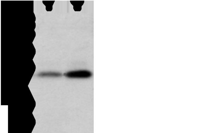 WFDC5 / PRG5 Antibody - Western blot analysis of Mouse trachea and brain tissue  using WFDC5 Polyclonal Antibody at dilution of 1:1100