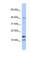 WFDC5 / PRG5 Antibody - WFDC5 antibody Western blot of Fetal Brain lysate. This image was taken for the unconjugated form of this product. Other forms have not been tested.