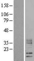 WFDC5 / PRG5 Protein - Western validation with an anti-DDK antibody * L: Control HEK293 lysate R: Over-expression lysate