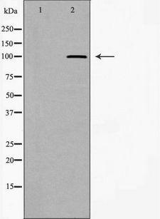 WFS1 Antibody - Western blot analysis of extracts of mouse brain tissue using WFS1 antibody. The lane on the left is treated with the antigen-specific peptide.
