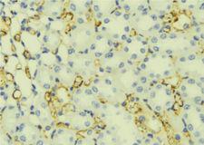 WFS1 Antibody - 1:100 staining mouse liver tissue by IHC-P. The sample was formaldehyde fixed and a heat mediated antigen retrieval step in citrate buffer was performed. The sample was then blocked and incubated with the antibody for 1.5 hours at 22°C. An HRP conjugated goat anti-rabbit antibody was used as the secondary.