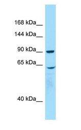 WHAMM Antibody - WHAMM antibody Western Blot of Placenta.  This image was taken for the unconjugated form of this product. Other forms have not been tested.