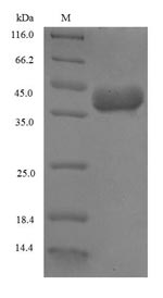 Omega-Gliadin Protein - (Tris-Glycine gel) Discontinuous SDS-PAGE (reduced) with 5% enrichment gel and 15% separation gel.