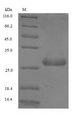 PLTP Protein - (Tris-Glycine gel) Discontinuous SDS-PAGE (reduced) with 5% enrichment gel and 15% separation gel.