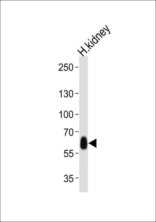 WHRN Antibody - Western blot of lysate from human kidney tissue lysate, using DFNB31 Antibody. Antibody was diluted at 1:1000 at each lane. A goat anti-rabbit IgG H&L (HRP) at 1:5000 dilution was used as the secondary antibody. Lysate at 35ug per lane.