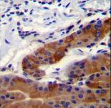 WHRN Antibody - DFNB31 Antibody immunohistochemistry of formalin-fixed and paraffin-embedded stomach tissue followed by peroxidase-conjugated secondary antibody and DAB staining.
