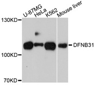 WHRN Antibody - Western blot analysis of extracts of various cell lines, using WHRN antibody at 1:1000 dilution. The secondary antibody used was an HRP Goat Anti-Rabbit IgG (H+L) at 1:10000 dilution. Lysates were loaded 25ug per lane and 3% nonfat dry milk in TBST was used for blocking. An ECL Kit was used for detection and the exposure time was 90s.