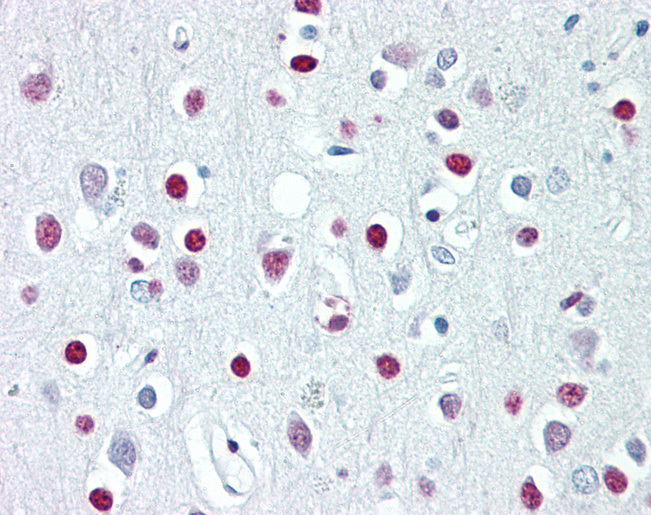 WHSC1 / NSD2 Antibody - Anti-WHSC1 / NSD2 antibody IHC of human brain, cortex. Immunohistochemistry of formalin-fixed, paraffin-embedded tissue after heat-induced antigen retrieval. Antibody dilution 2.5-5 ug/ml. This image was taken for the unconjugated form of this product. Other forms have not been tested.