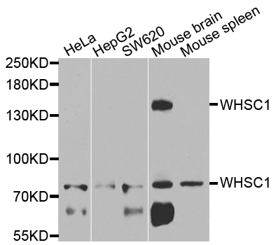 WHSC1 / NSD2 Antibody - Western blot analysis of extracts of various cells.