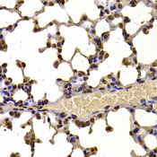 WHSC1 / NSD2 Antibody - Immunohistochemistry of paraffin-embedded mouse lung tissue.