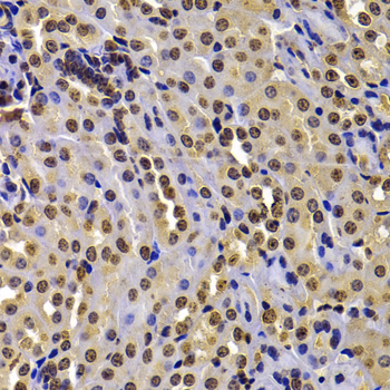 WHSC1 / NSD2 Antibody - Immunohistochemistry of paraffin-embedded mouse kidney tissue.