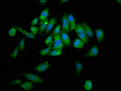 WHSC1 / NSD2 Antibody - Immunofluorescence staining of Hela cells at a dilution of 1:133, counter-stained with DAPI. The cells were fixed in 4% formaldehyde, permeabilized using 0.2% Triton X-100 and blocked in 10% normal Goat Serum. The cells were then incubated with the antibody overnight at 4 °C.The secondary antibody was Alexa Fluor 488-congugated AffiniPure Goat Anti-Rabbit IgG (H+L) .