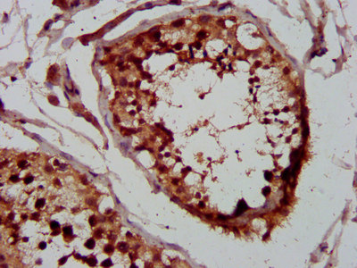 WHSC1 / NSD2 Antibody - Immunohistochemistry image at a dilution of 1:400 and staining in paraffin-embedded human testis tissue performed on a Leica BondTM system. After dewaxing and hydration, antigen retrieval was mediated by high pressure in a citrate buffer (pH 6.0) . Section was blocked with 10% normal goat serum 30min at RT. Then primary antibody (1% BSA) was incubated at 4 °C overnight. The primary is detected by a biotinylated secondary antibody and visualized using an HRP conjugated SP system.
