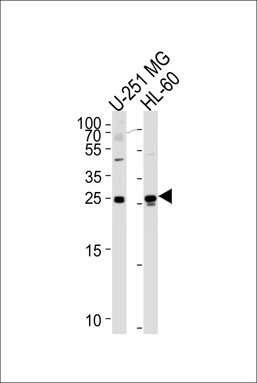 WIBG Antibody - Western blot of lysates from U-251 MG, HL-60 cell line (from left to right), using WIBG Antibody. Antibody was diluted at 1:1000 at each lane. A goat anti-rabbit IgG H&L (HRP) at 1:5000 dilution was used as the secondary antibody. Lysates at 35ug per lane.