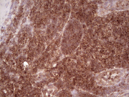 WIBG Antibody - Immunohistochemical staining of paraffin-embedded Human tonsil within the normal limits using anti-WIBG mouse monoclonal antibody. (Heat-induced epitope retrieval by 1 mM EDTA in 10mM Tris, pH8.5, 120C for 3min,