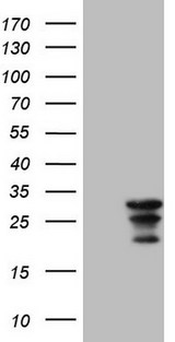 WIBG Antibody - HEK293T cells were transfected with the pCMV6-ENTRY control (Left lane) or pCMV6-ENTRY WIBG (Right lane) cDNA for 48 hrs and lysed. Equivalent amounts of cell lysates (5 ug per lane) were separated by SDS-PAGE and immunoblotted with anti-WIBG.