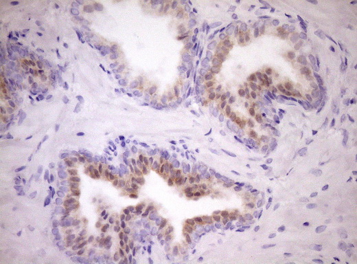 WIBG Antibody - Immunohistochemical staining of paraffin-embedded Human prostate tissue within the normal limits using anti-WIBG mouse monoclonal antibody. (Heat-induced epitope retrieval by Tris-EDTA, pH8.0)(1:150)