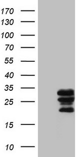 WIBG Antibody - HEK293T cells were transfected with the pCMV6-ENTRY control (Left lane) or pCMV6-ENTRY WIBG (Right lane) cDNA for 48 hrs and lysed. Equivalent amounts of cell lysates (5 ug per lane) were separated by SDS-PAGE and immunoblotted with anti-WIBG (1:2000).