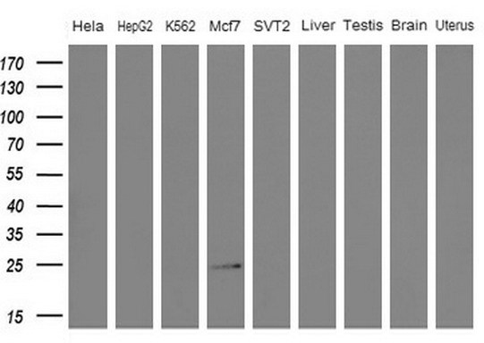 WIBG Antibody - Western blot analysis of extracts. (10ug) from 5 different cell lines and 4 human tissue by using anti-WIBG monoclonal antibody. (1: Hela; 2: HepG2; 3: K562; 4: Mcf7; 5: SVT2; 6: Liver; 7: Testis; 8: Brain; 9: Uterus) at 1:200 dilution.