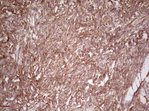 WIBG Antibody - Immunohistochemical staining of paraffin-embedded Human Ovary tissue within the normal limits using anti-WIBG mouse monoclonal antibody. (Heat-induced epitope retrieval by 1 mM EDTA in 10mM Tris, pH8.5, 120C for 3min,