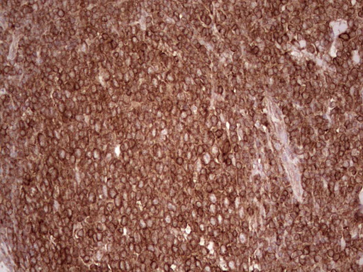 WIBG Antibody - Immunohistochemical staining of paraffin-embedded Human tonsil within the normal limits using anti-WIBG mouse monoclonal antibody. (Heat-induced epitope retrieval by 1 mM EDTA in 10mM Tris, pH8.5, 120C for 3min,