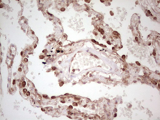 WIBG Antibody - Immunohistochemical staining of paraffin-embedded Human lung tissue within the normal limits using anti-WIBG mouse monoclonal antibody. (Heat-induced epitope retrieval by 1 mM EDTA in 10mM Tris, pH8.5, 120C for 3min,