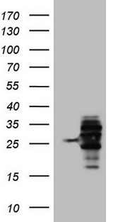 WIBG Antibody - HEK293T cells were transfected with the pCMV6-ENTRY control (Left lane) or pCMV6-ENTRY WIBG (Right lane) cDNA for 48 hrs and lysed. Equivalent amounts of cell lysates (5 ug per lane) were separated by SDS-PAGE and immunoblotted with anti-WIBG.