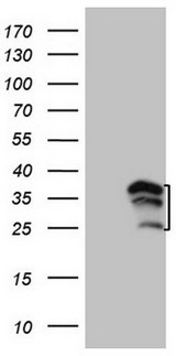 WIBG Antibody - HEK293T cells were transfected with the pCMV6-ENTRY control. (Left lane) or pCMV6-ENTRY WIBG. (Right lane) cDNA for 48 hrs and lysed. Equivalent amounts of cell lysates. (5 ug per lane) were separated by SDS-PAGE and immunoblotted with anti-WIBG.
