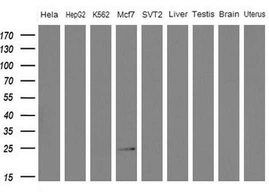 WIBG Antibody - Western blot analysis of extracts. (10ug) from 5 different cell lines and 4 human tissue by using anti-WIBG monoclonal antibody. (1: Hela; 2: HepG2; 3: K562; 4: Mcf7; 5: SVT2; 6: Liver; 7: Testis; 8: Brain; 9: Uterus) at 1:200 dilution.