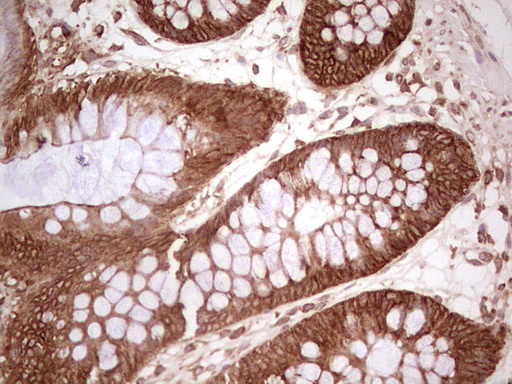 WIBG Antibody - Immunohistochemical staining of paraffin-embedded Human colon tissue within the normal limits using anti-WIBG mouse monoclonal antibody. (Heat-induced epitope retrieval by 1 mM EDTA in 10mM Tris, pH8.5, 120C for 3min,