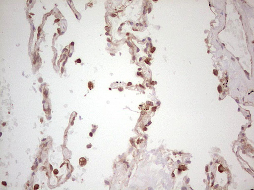 WIBG Antibody - IHC of paraffin-embedded Human lung tissue using anti-WIBG mouse monoclonal antibody. (Heat-induced epitope retrieval by 1 mM EDTA in 10mM Tris, pH8.5, 120°C for 3min).