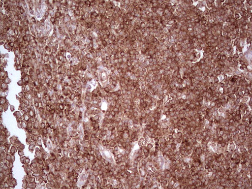 WIBG Antibody - IHC of paraffin-embedded Human tonsil using anti-WIBG mouse monoclonal antibody. (Heat-induced epitope retrieval by 1 mM EDTA in 10mM Tris, pH8.5, 120°C for 3min).