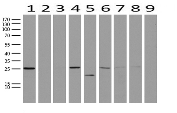 WIBG Antibody - Western blot analysis of extracts. (15ug) from 9 Human tissue by using anti-WIBG monoclonal antibody. (1: Testis; 2: Uterus; 3: Breast; 4: Brain; 5: Liver; 6: Ovary; 7: Thyroid gland; 8: colon:;9:Spleen). (1:500) Dilution: 1:500