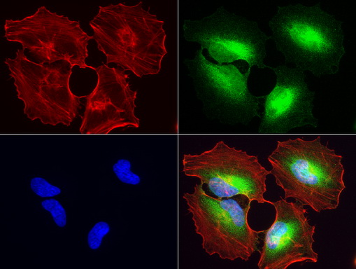 WIBG Antibody - Immunofluorescent staining of HeLa cells using anti-WIBG mouse monoclonal antibody  green, 1:50). Actin filaments were labeled with Alexa Fluor® 594 Phalloidin. (red), and nuclear with DAPI. (blue).