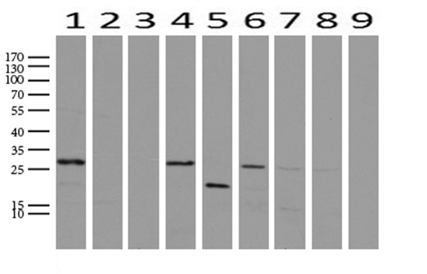 WIBG Antibody - Western blot analysis of extracts. (15ug) from 9 Human tissue by using anti-WIBG monoclonal antibody. (1: Testis; 2: Uterus; 3: Breast; 4: Brain; 5: Liver; 6: Ovary; 7: Thyroid gland; 8: colon:;9:Spleen). (1:500) Dilution: 1:500