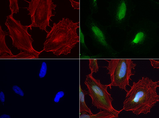 WIBG Antibody - Immunofluorescent staining of HeLa cells using anti-WIBG mouse monoclonal antibody  green, 1:100). Actin filaments were labeled with Alexa Fluor® 594 Phalloidin. (red), and nuclear with DAPI. (blue).