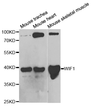 WIF1 Antibody - Western blot analysis of extracts of various cell lines.