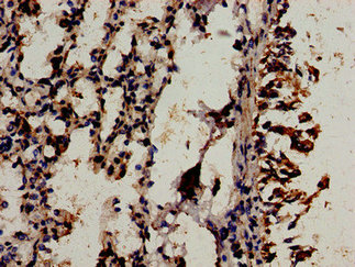 WIF1 Antibody - Immunocytochemistry analysis of human lung tissue at a dilution of 1:100