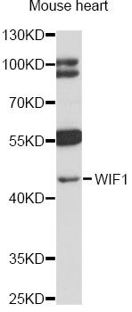 WIF1 Antibody - Western blot analysis of extracts of mouse heart, using WIF1 antibody at 1:1000 dilution. The secondary antibody used was an HRP Goat Anti-Rabbit IgG (H+L) at 1:10000 dilution. Lysates were loaded 25ug per lane and 3% nonfat dry milk in TBST was used for blocking. An ECL Kit was used for detection and the exposure time was 90s.