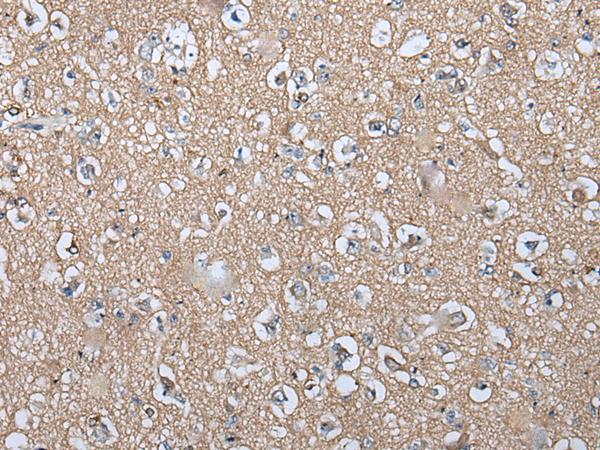 WIF1 Antibody - Immunohistochemistry of paraffin-embedded Human brain tissue  using WIF1 Polyclonal Antibody at dilution of 1:100(×200)