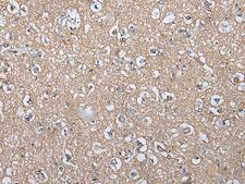 WIF1 Antibody - Immunohistochemistry of paraffin-embedded Human brain tissue  using WIF1 Polyclonal Antibody at dilution of 1:100(×200)