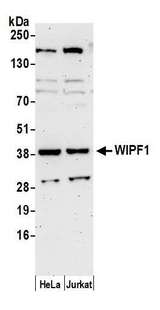 WIPF1 / WIP Antibody - Detection of human WIPF1 by western blot. Samples: Whole cell lysate (50 µg) from HeLa and Jurkat cells prepared using NETN lysis buffer. Antibody: Affinity purified rabbit anti-WIPF1 antibody used for WB at 0.1 µg/ml. Detection: Chemiluminescence with an exposure time of 3 minutes.