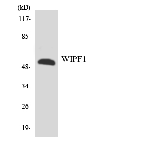 WIPF1 / WIP Antibody - Western blot analysis of the lysates from HT-29 cells using WIPF1 antibody.